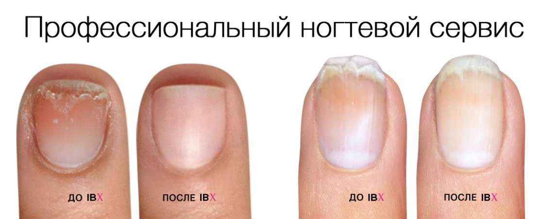IBX System для ногтей